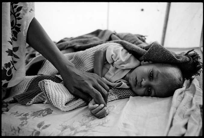 A child infected by tuberculosis, field hospital, Afabet refugee camp - © Giulio Napolitano